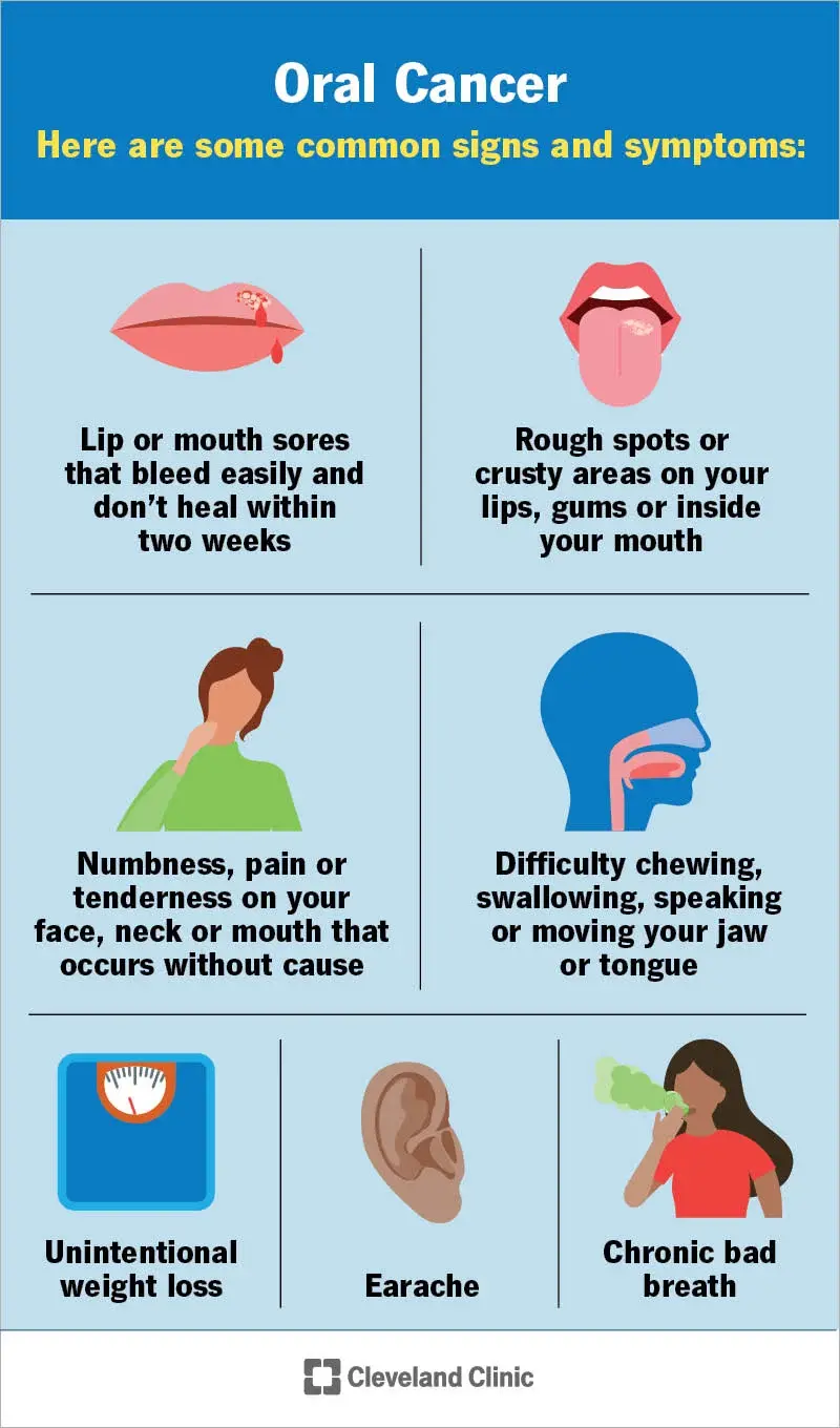 Oral cancer — know the signs
